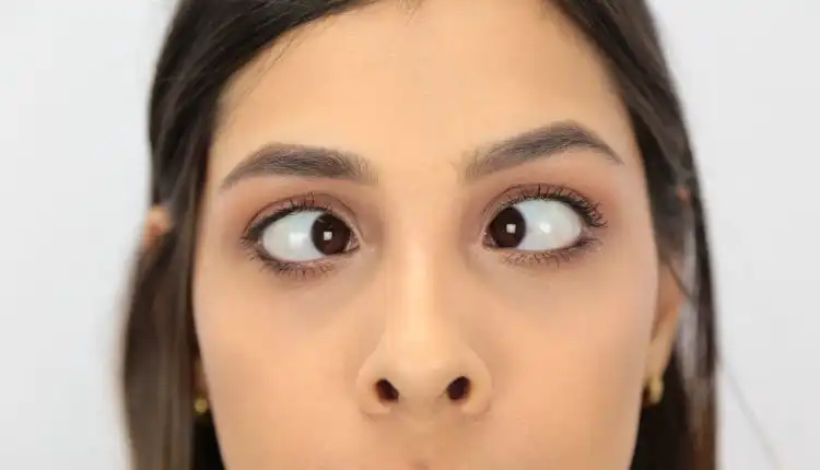 Tempat Pengobatan Mata Juling di Jakarta Terbaik dan Tanpa Operasi