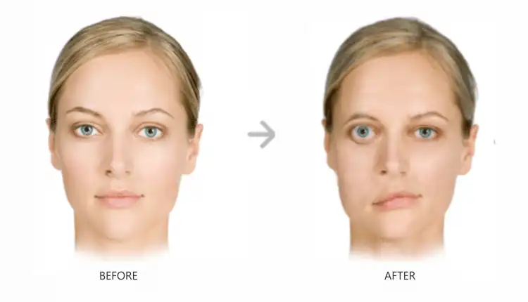 Tempat Pengobatan Mestiagrafis di Jakarta Terbaik dan Tanpa Obat Kimia