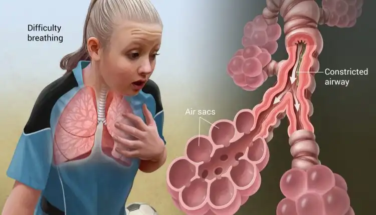 Tempat Pengobatan Vertigo di Jakarta Terpercaya dan Cepat Sembuh