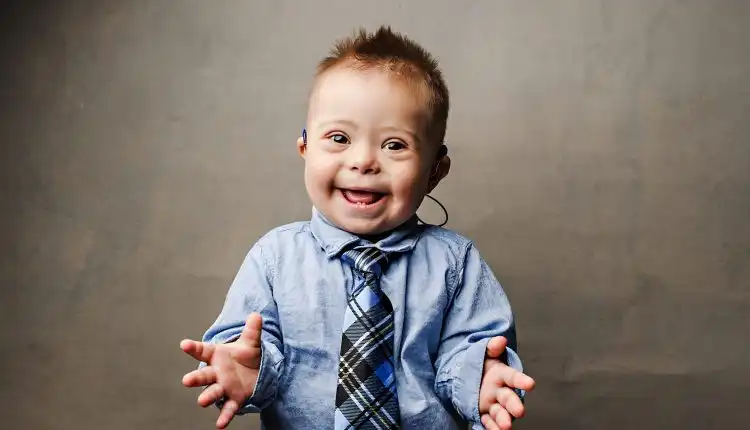 Tempat Pengobatan Down Syndrom di Jakarta Paling Tepat dan Nyaman