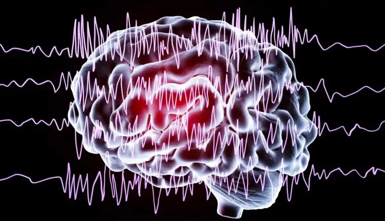 Tempat Pengobatan Epilepsi di Jakarta Tanpa Obat-Obatan Kimia Berbahaya