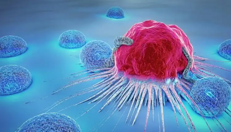 Tempat Pengobatan Kanker di Jakarta Profesional dan Sangat Nyaman