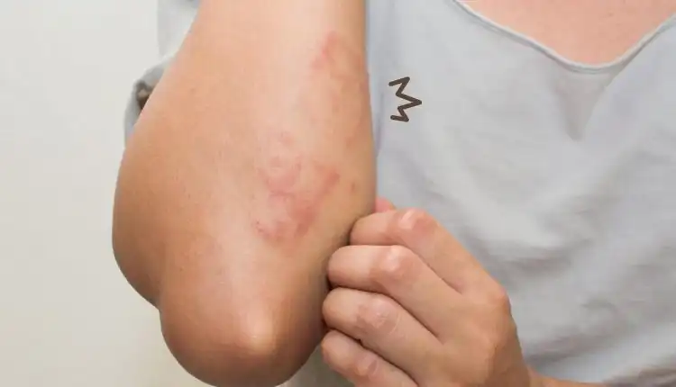 Tempat Pengobatan TBC di Jakarta yang Profesional dan Sangat Ahli