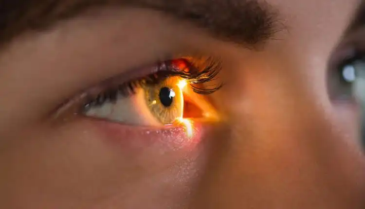 Tempat Pengobatan Glukoma di Jakarta Profesional dan Terpercaya