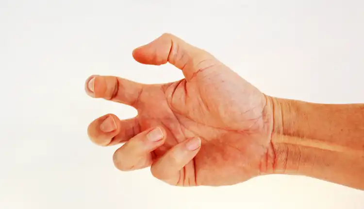 Tempat Pengobatan Dystonia di Depok Paling Terkenal dan Cepat Sembuh