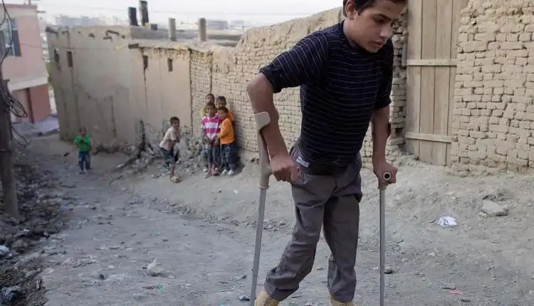 Tempat Pengobatan Polio di Depok Profesional dan Bisa Cepat Sembuh