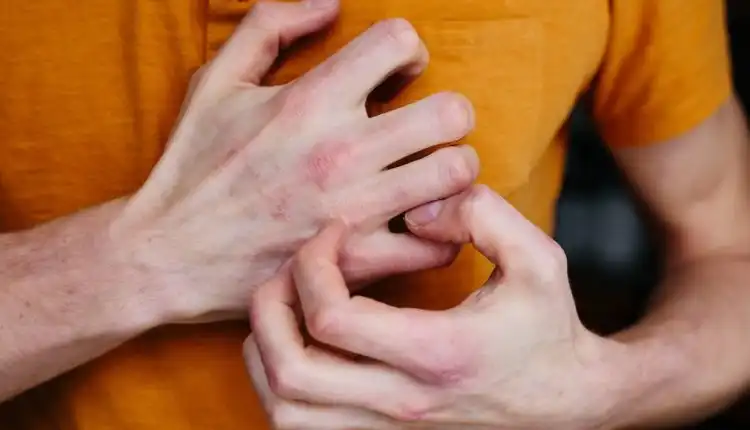 Tempat Pengobatan Diabetes di Depok Paling Cepat Sembuh dan Populer