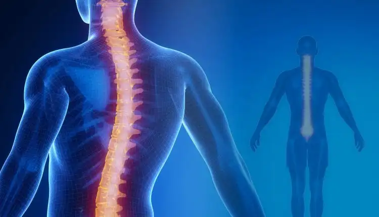 Tempat Pengobatan Skoliosis di Depok yang Aman dan Paling Nyaman