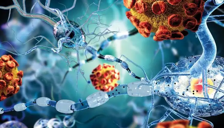 Tempat Pengobatan Autoimun di Tangerang dan Palembang Profesional