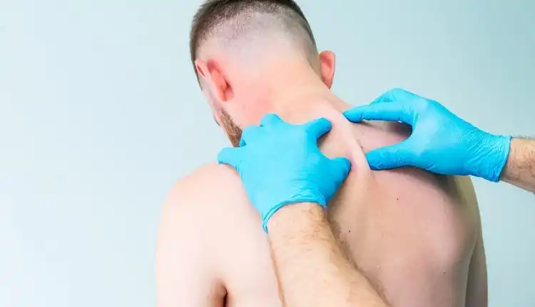 Tempat Pengobatan Autonom Dysreflexia (AD) di Tangerang Paling Direkomendasikan