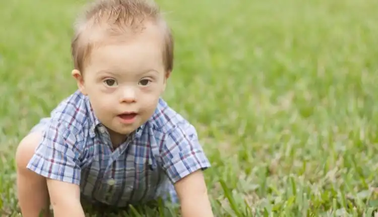 Tempat Pengobatan Down Syndrom di Tangerang dan Palembang Aman dan Nyaman