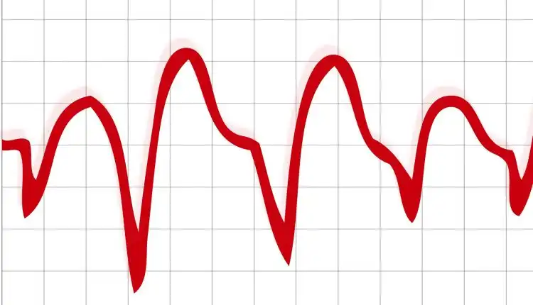 Tempat Pengobatan Takikardia di Tangerang Terpercaya dan Direkomendasikan