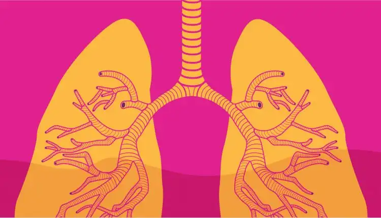 Tempat Pengobatan Asma di Pekanbaru dan Bekasi yang Manjur Tanpa Obat