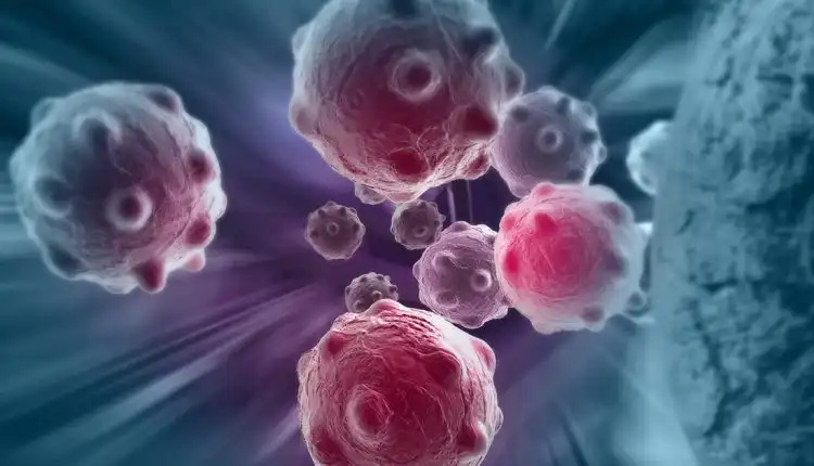 Tempat Pengobatan Kanker di Pekanbaru dan Bekasi Tanpa Obat atau Operasi