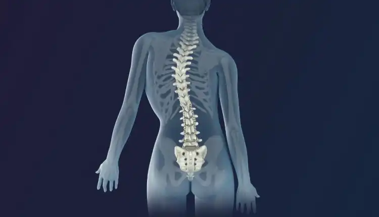 Tempat Pengobatan Skoliosis di Pekanbaru dan Bekasi Alternatif yang Profesional