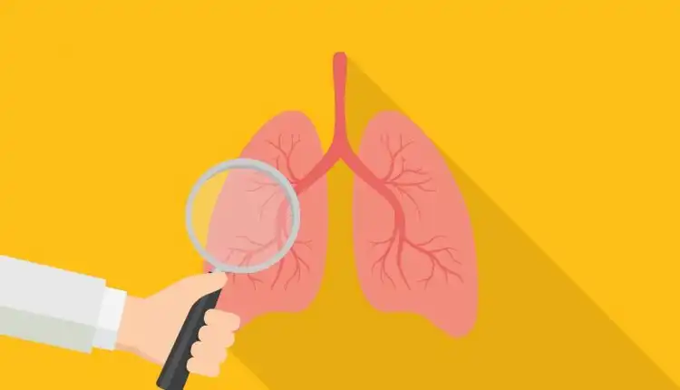 Tempat Pengobatan TBC di Pekanbaru dan Bekasi Profesional dan Terpercaya