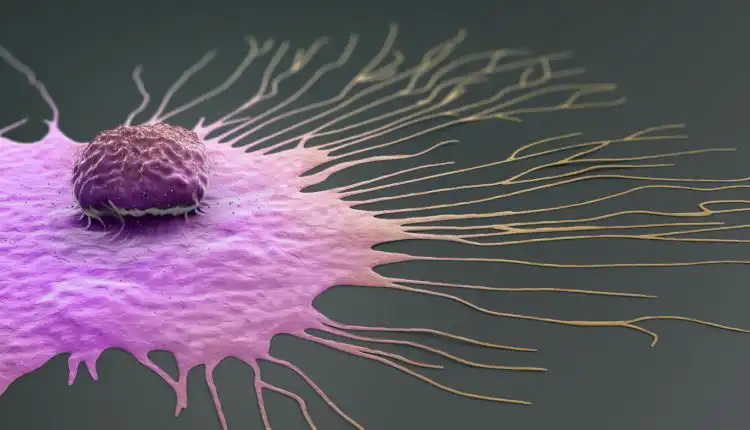 Tempat Pengobatan Benjolan Payudara di Pekanbaru dan Bekasi Tanpa Operasi