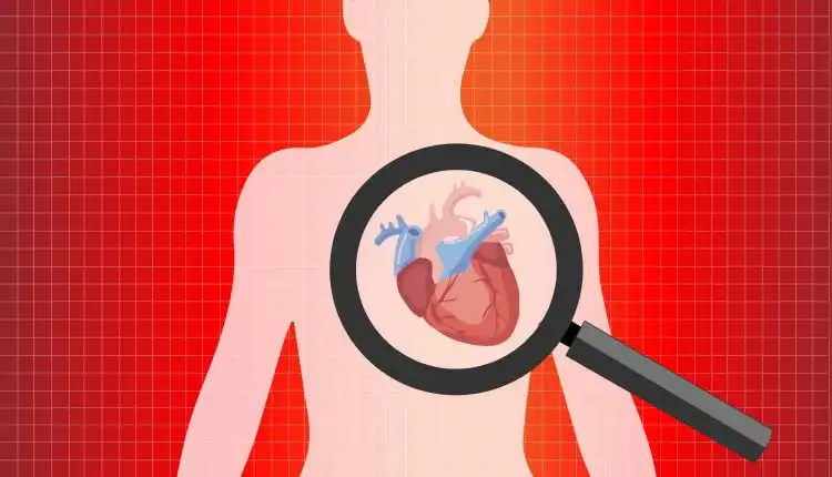 Tempat Pengobatan Jantung di Pekanbaru dan Bekasi Tanpa Operasi atau Obat Kimia