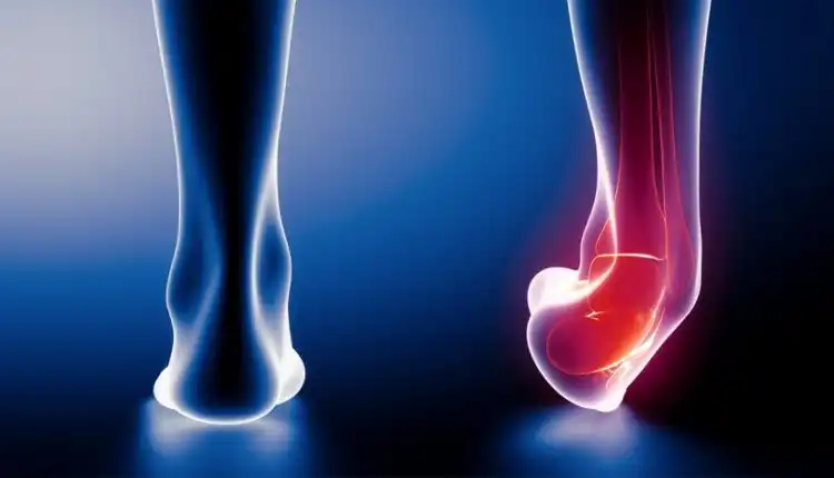 Terapi Keseleo Tulang di Pekanbaru dan Bekasi yang Aman dan Nyaman