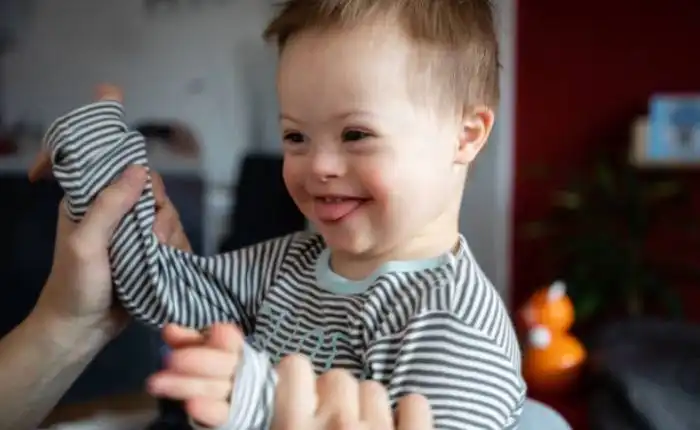 Tempat Pengobatan Down Syndrom di Bintaro Terbaik