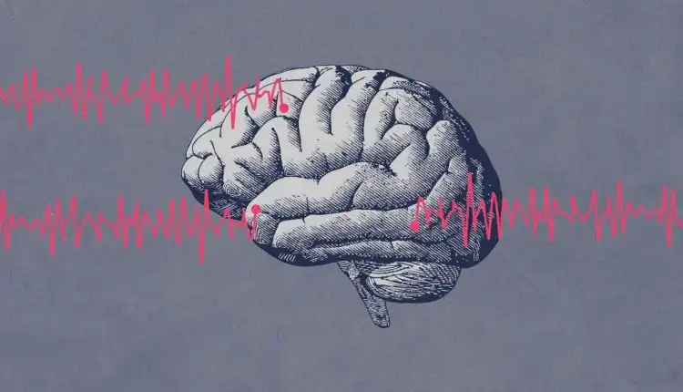 Tempat Pengobatan Epilepsi di Bintaro yang Paling Mujarab