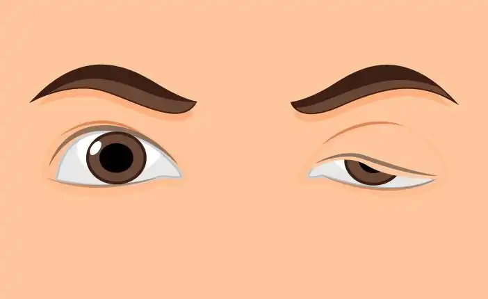 Tempat Pengobatan Mestiagrafis di Bintaro Paling Dicari