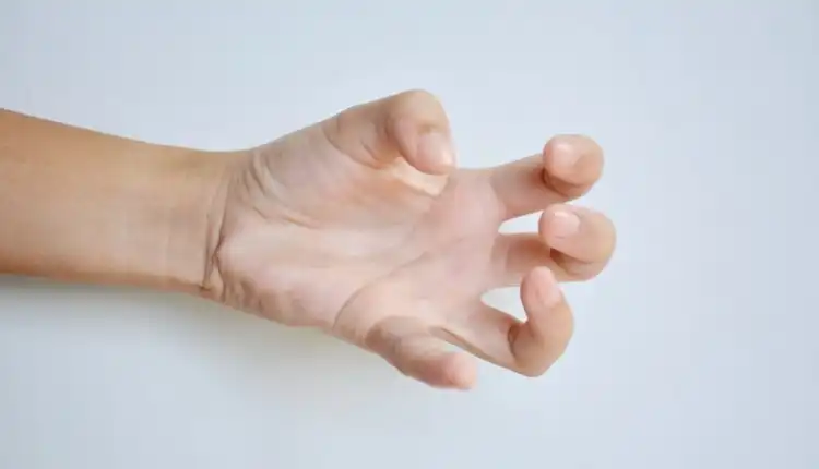 Apa itu Dystonia Fokal?