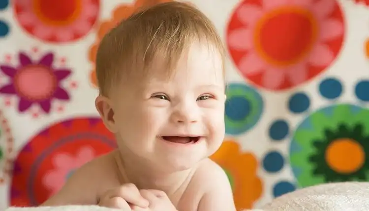 Tempat Pengobatan Down Syndrom di Cikarang Paling Populer