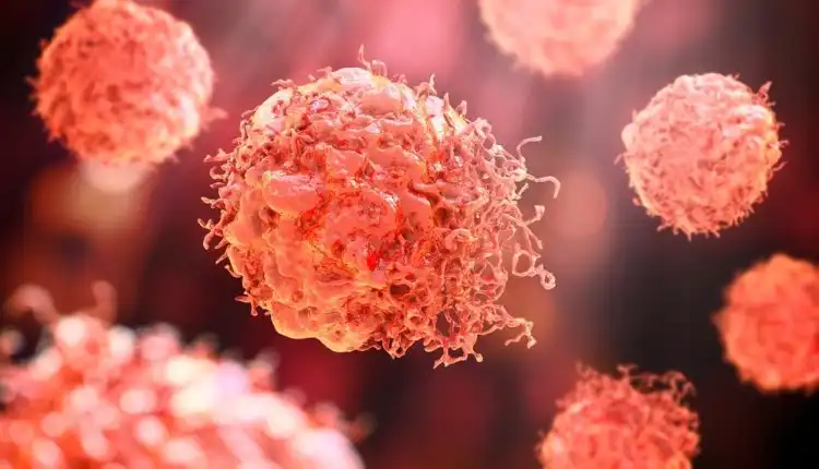 Tempat Pengobatan Kanker di Cikarang Tanpa Obat dan Operasi