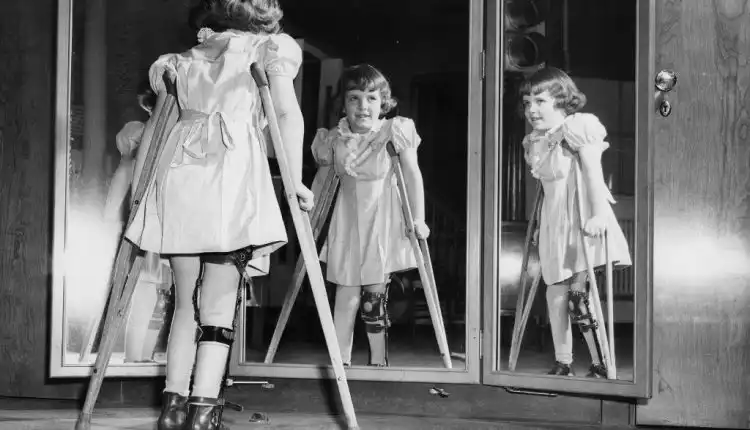 Tempat Pengobatan Polio di Cikarang Paling Aman dan Nyaman