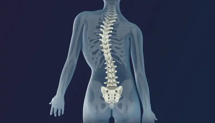 Tempat Pengobatan Skoliosis di Cikarang Paling Aman dan Nyaman