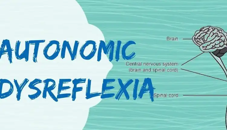 Tempat Pengobatan Autonom Dysreflexia (AD) di Cikarang Terbaik