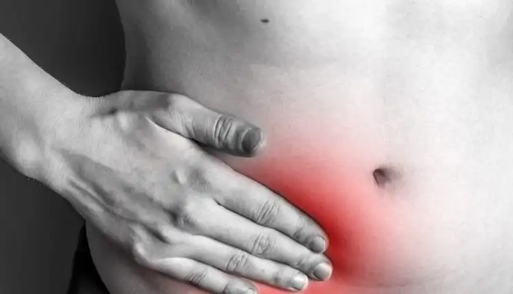 Tempat Pengobatan Hernia di Cikarang Profesional dan Terbaik