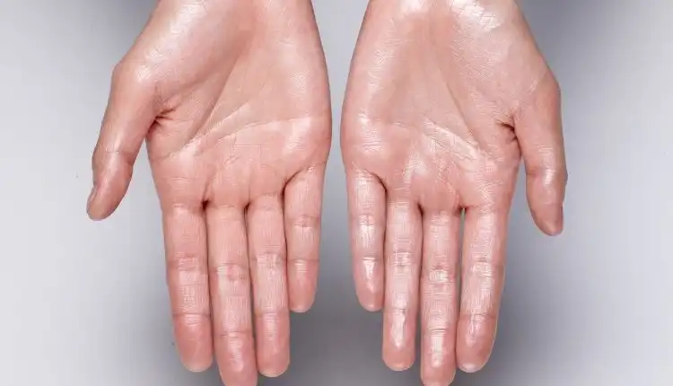 Tempat Pengobatan Jantung Lemah di Cikarang Mujarab dan Cepat Sembuh