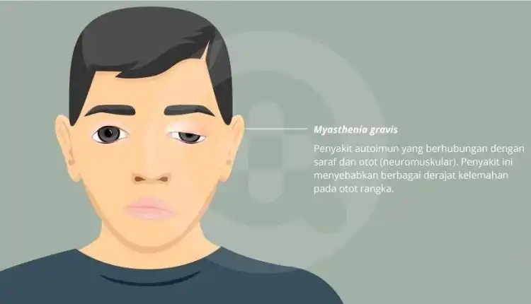 Tempat Pengobatan Mestiagrafis di Cikarang Terpercaya dan Profesional