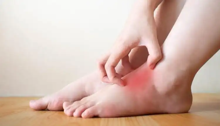 Tempat Pengobatan Penyakit Gula di Cikarang Terbaik dan Tanpa Obat