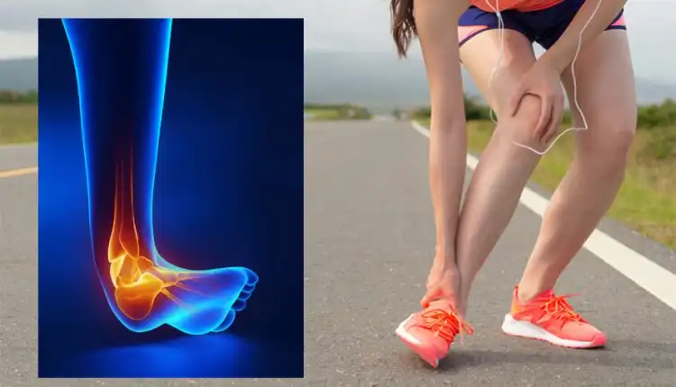 Terapi Keseleo Tulang di Cikarang yang Mujarab dan Nyaman