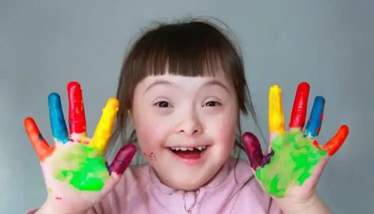 Tempat Pengobatan Down Syndrom di Bangkinang Paling Nyaman Tanpa Obat