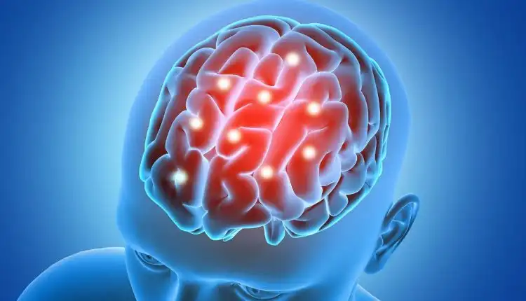 Tempat Pengobatan Infeksi Meningitis di Bangkinang Terpercaya dan Tanpa Efek Samping