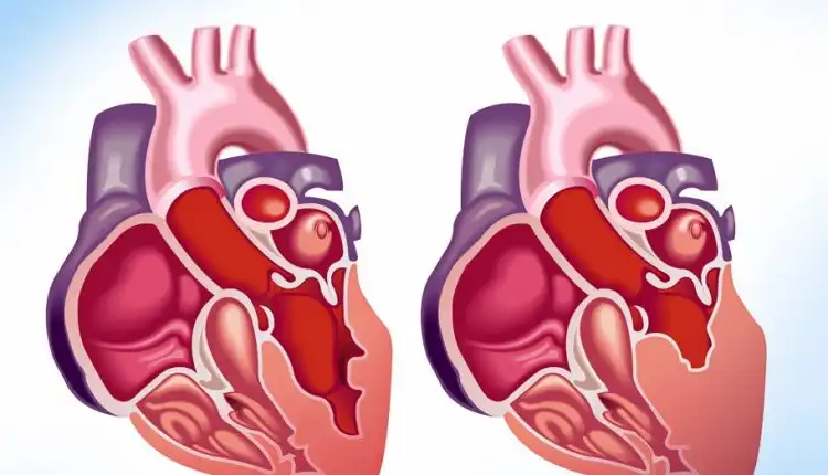 Tempat Pengobatan Jantung Lemah di Bangkinang Terbaik dan Terpercaya