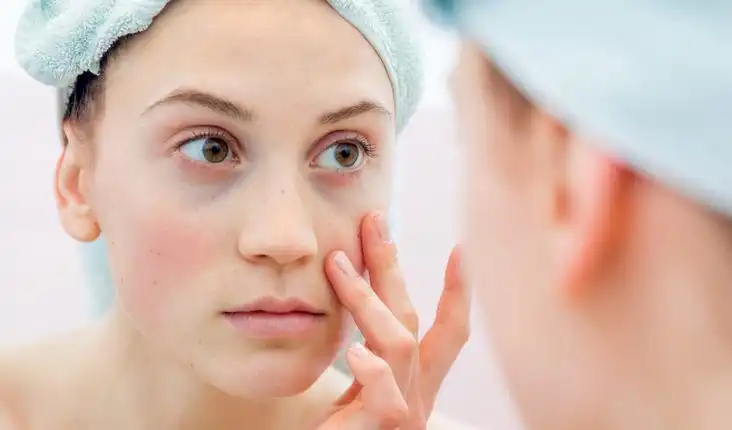 Tempat Pengobatan Lupus di Bangkinang Paling Populer