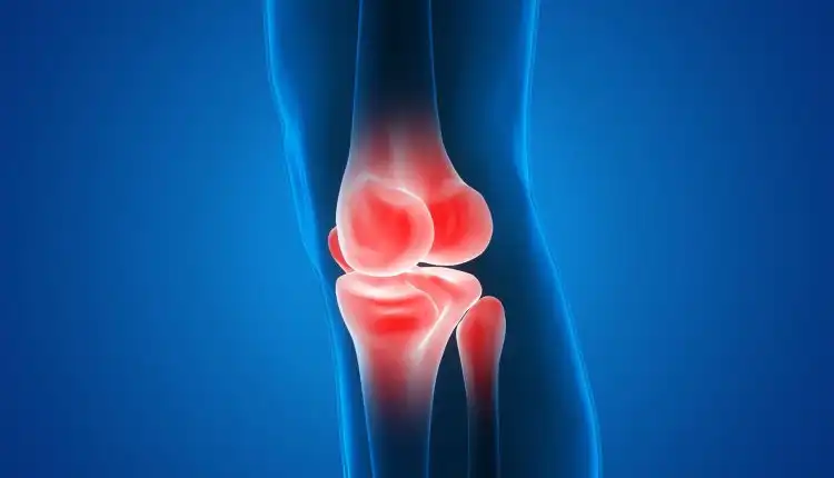 Tempat Pengobatan Osteomielitis atau Infeksi Tulang di Cibitung Tanpa Operasi