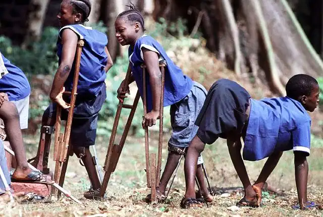 Tempat Pengobatan Polio di Bangkinang Paling Direkomendasikan