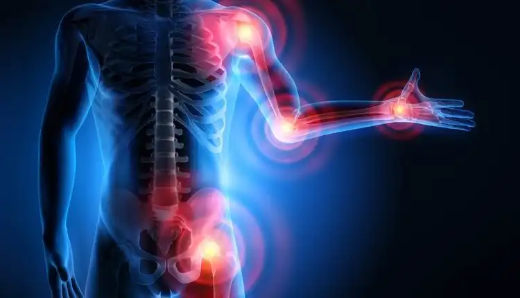 Tempat Pengobatan Radang Sendi di Bangkinang Terpercaya dan Paling Dicari