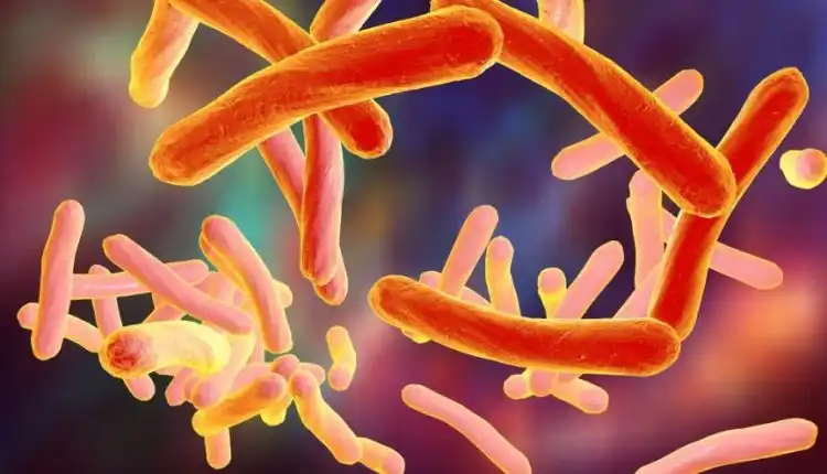 Tempat Pengobatan TBC di Bangkinang yang Nyaman dan Direkomendasikan