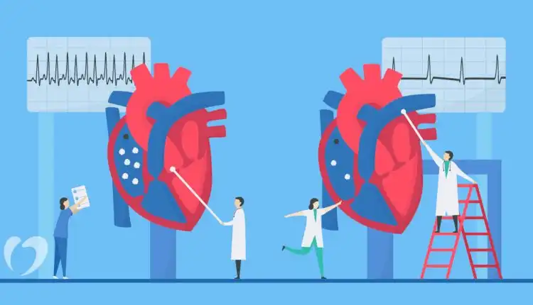 Tempat Pengobatan Takikardia di Bangkinang Tanpa Obat Kimia