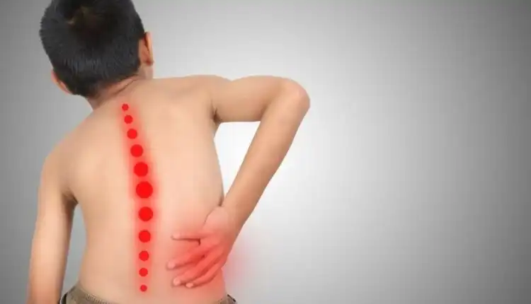 Tempat Pengobatan Skoliosis di Bangkinang yang Efektif dan Mujarab