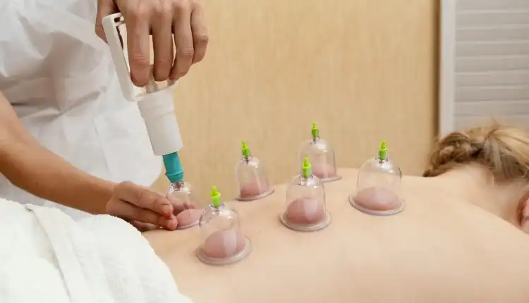 Revitalisasi Kesehatan Anda Promo Kemerdekaan Terapi Bekam yang Tidak Boleh Dilewatkan