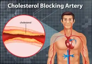 Bunga Ini Sebagai Solusi Kolesterol Tinggi Hingga Kanker