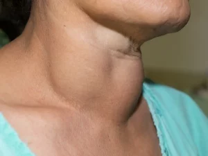 gondok medical hacking